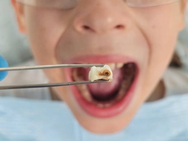 Best Tooth Pain Emergency Relief  in New Market, MD
